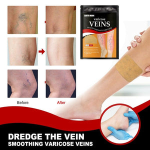 DeeTrade Foot Care Varicose Vein Healing Patches